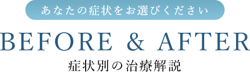 あなたの歯並びをお選びください